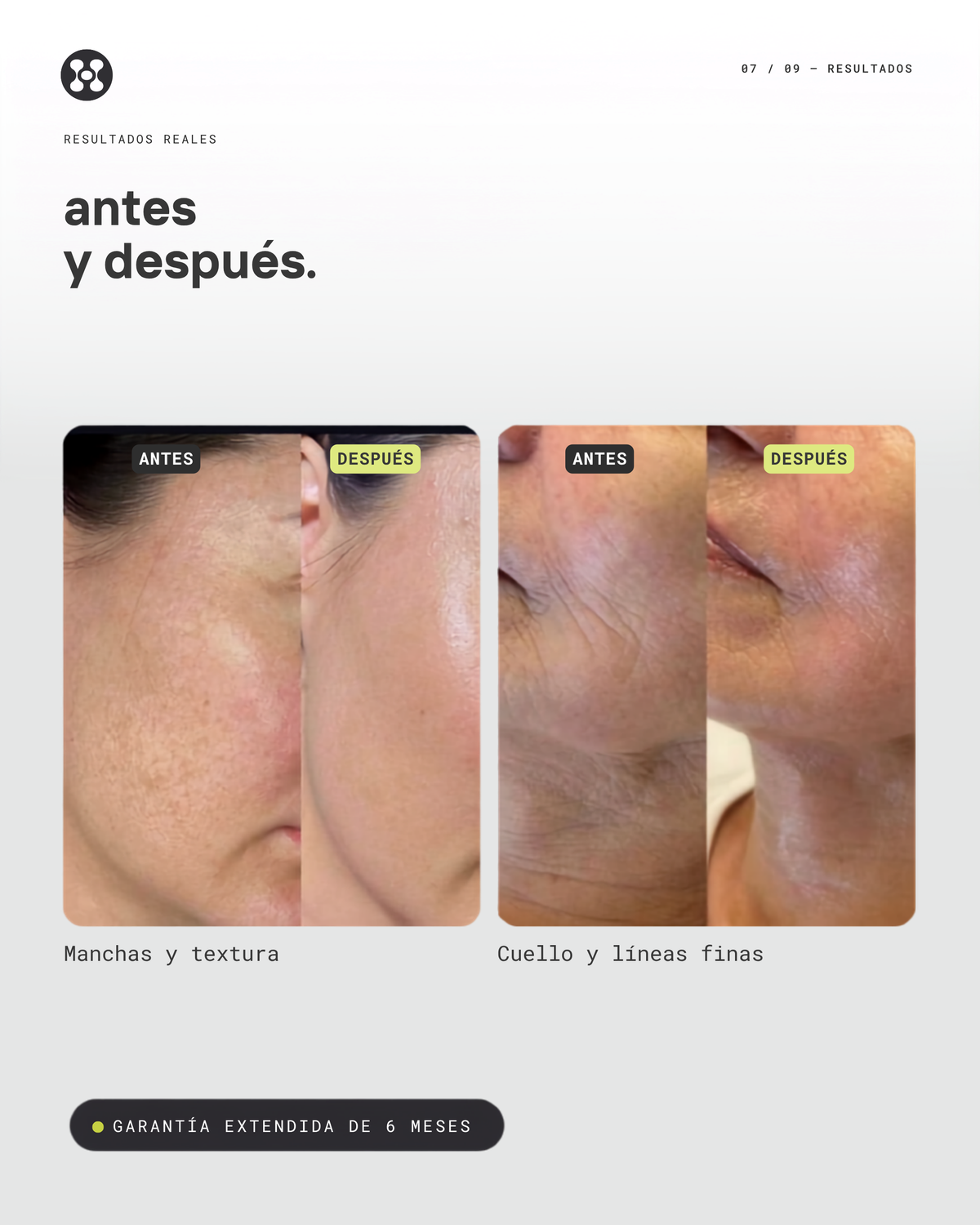 Varita Skincare · 6-en-1
